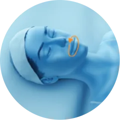 EMface facial toning Dublin - 3D head diagram showing the area around the mouth 3D head diagram showing the area around the mouth for EMface facial toning in Dublin